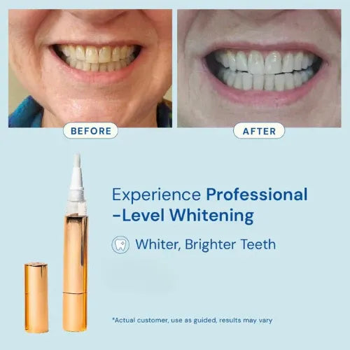 Instawhite™ Teeth Whitening Serum Pen